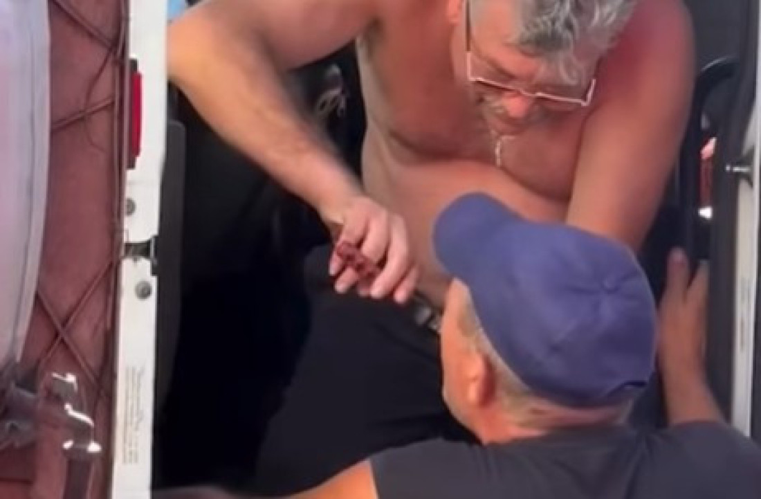 Kamiondžija izvadio zub kolegi kleštima na parkingu