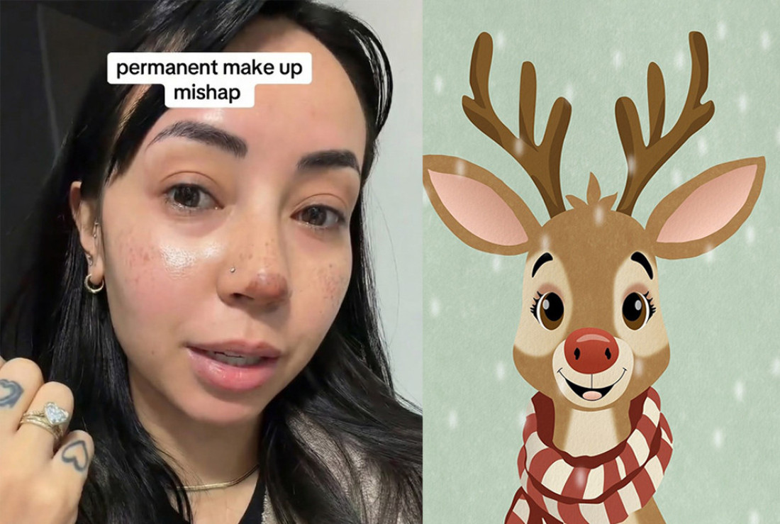 Išla na konturisanje nosa, pa ga ribala turpijom za pete