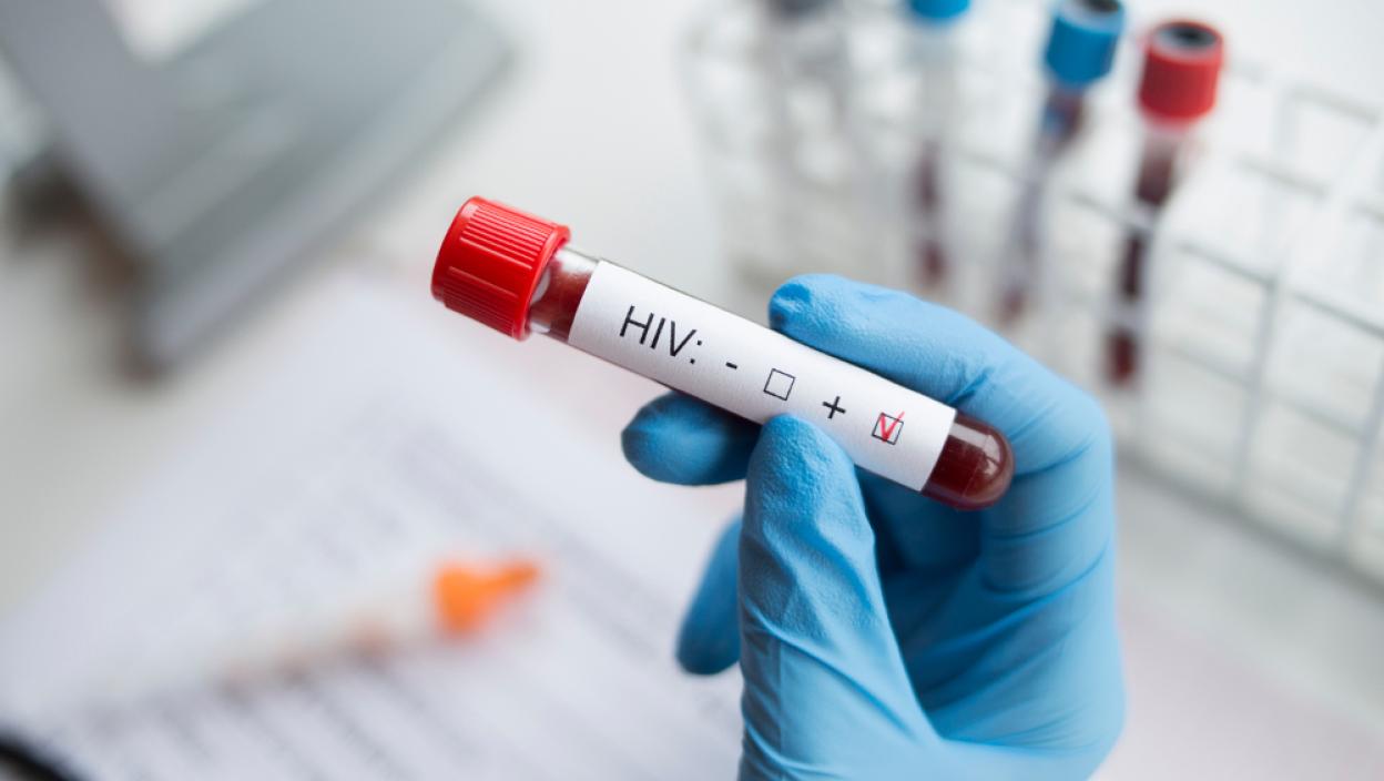 Muškarac pretio da će širiti HIV, odmah priveden