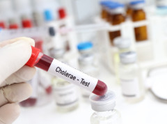 U epidemiji kolere u Nigeriji preminulo najmanje 74 osoba, zaraženo više od 7.800