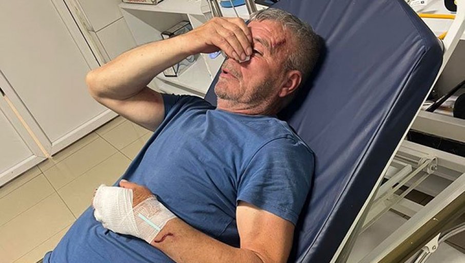 Pretrpeo brutalan napad od strane lokalnog Albanca